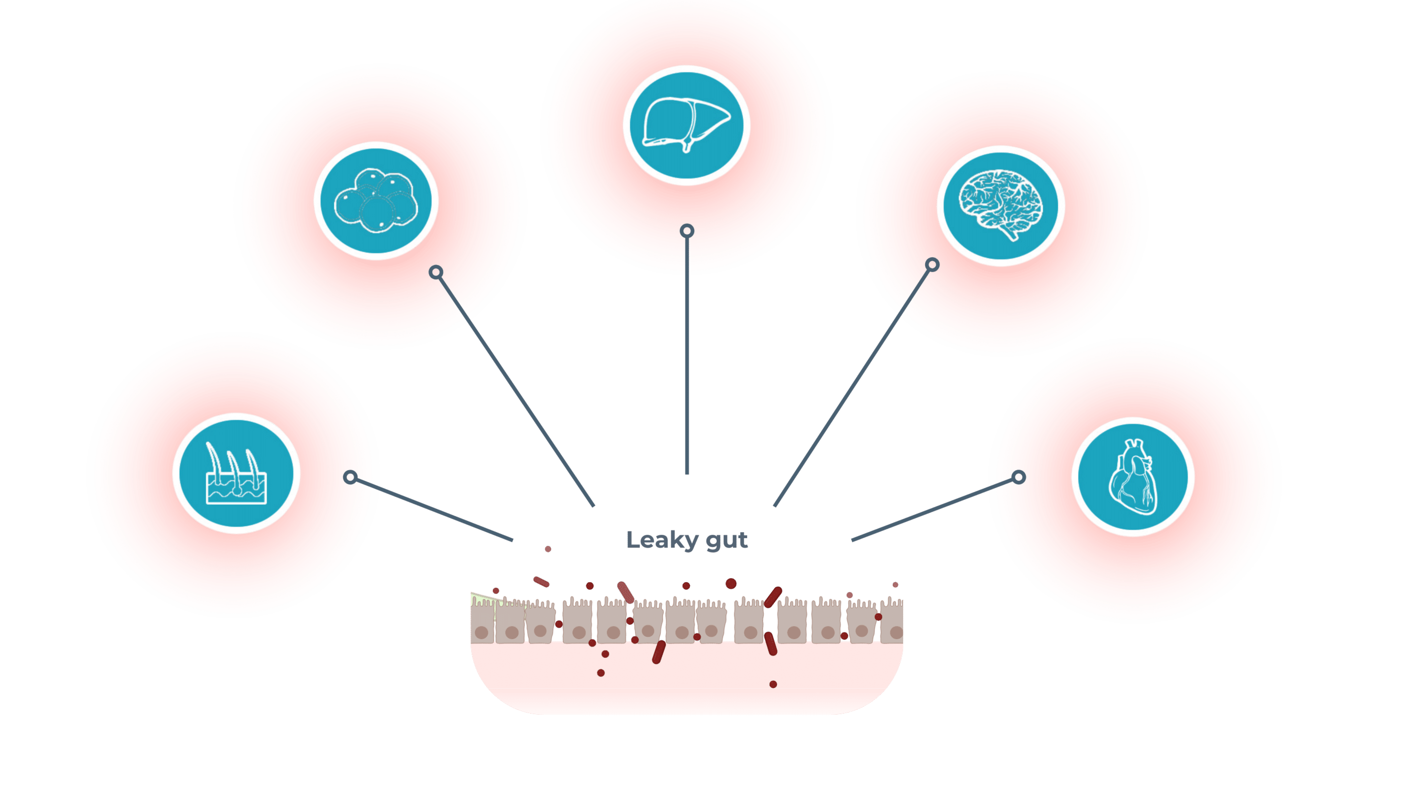 leaky-gut-organs